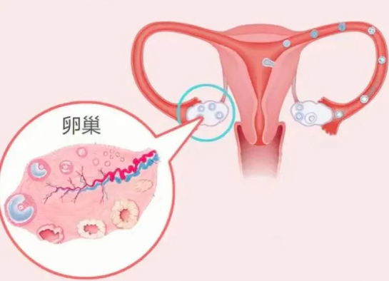 「试管婴儿」性激素六项检查的最佳时期！