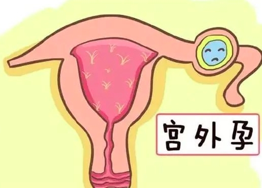 「专治各种不孕」3次宫外孕，在玛丽如愿怀上龙宝！