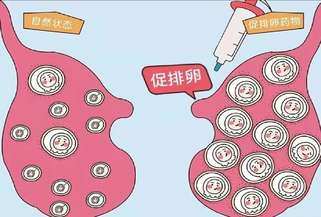 「试管婴儿」试管助孕取卵越多越好吗？