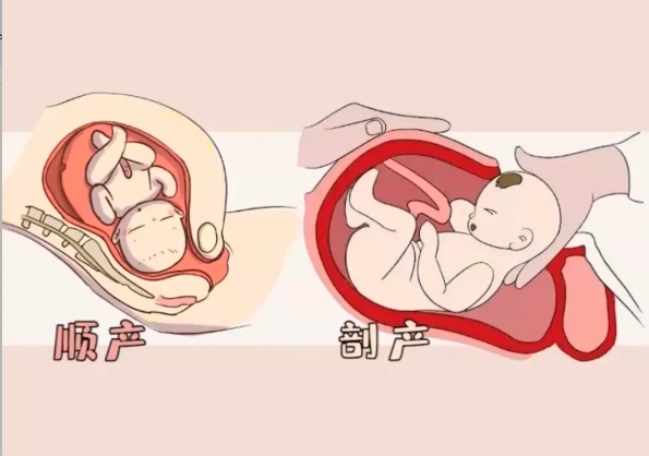 产后盆底康复：妈妈们不可忽视的健康必修课，一定要收藏！