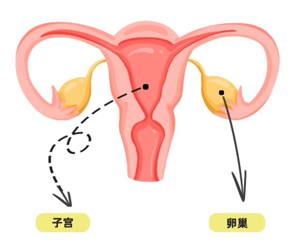 转载：临床研究 | CA 125消除速率常数K评分对高级别卵巢浆液性癌行间歇性肿瘤细胞减灭术患者预后的预测作用