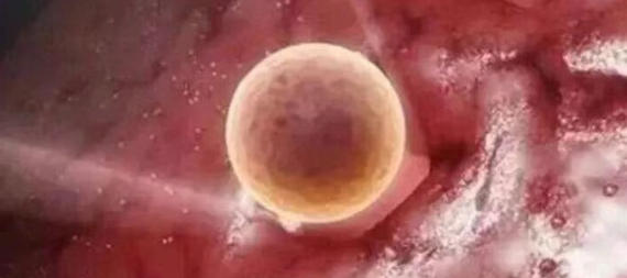「试管婴儿」胚胎着床后试管保胎有多重要？